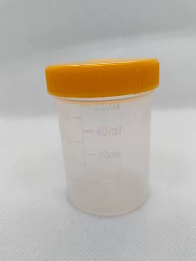 URINE CONTAINER